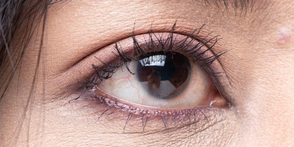 Выяснение значения подергивания нижнего правого глаза из медицинских очков