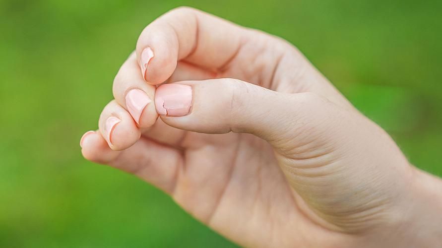 Orsaker till trasiga naglar, inklusive skador och infektioner