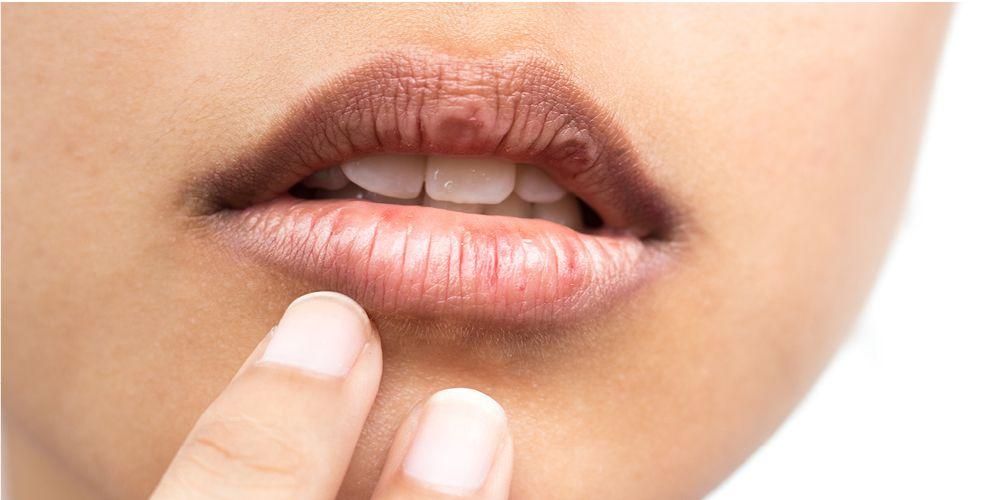 7 przyczyn swędzenia ust i jak je przezwyciężyć