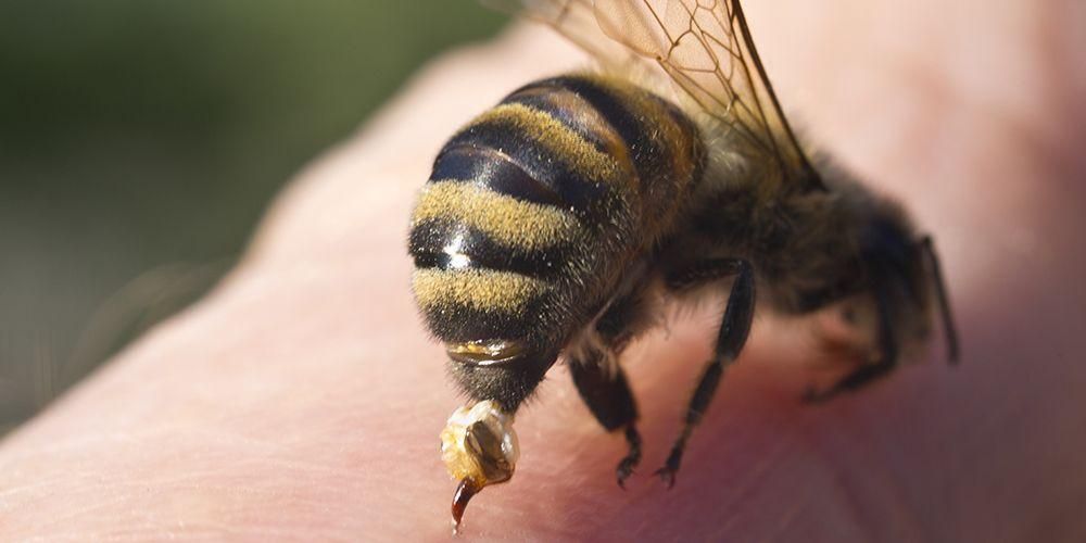 Лечение пчелиного укуса натуральными ингредиентами в домашних условиях
