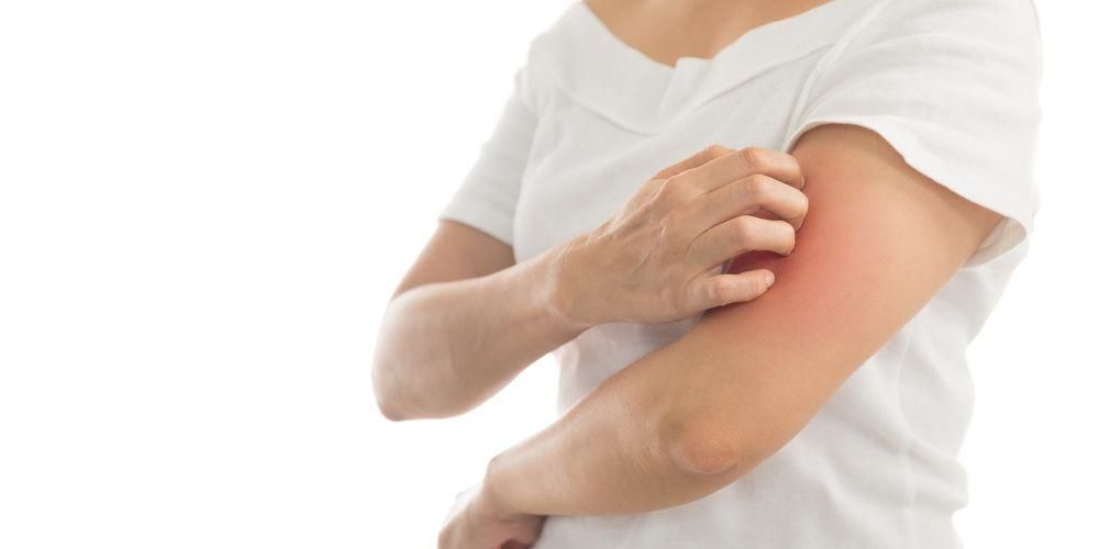 4 fajta ótvaros bőr gombás fertőzés, amely viszketést és kényelmetlenséget okoz