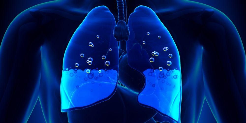 Kan vätska i lungorna försvinna? Detta är förklaringen