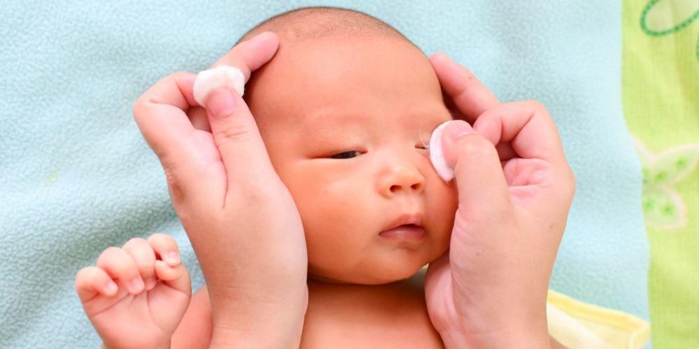 Baby Belekan Eyes: oorzaken en de juiste manier om het te overwinnen