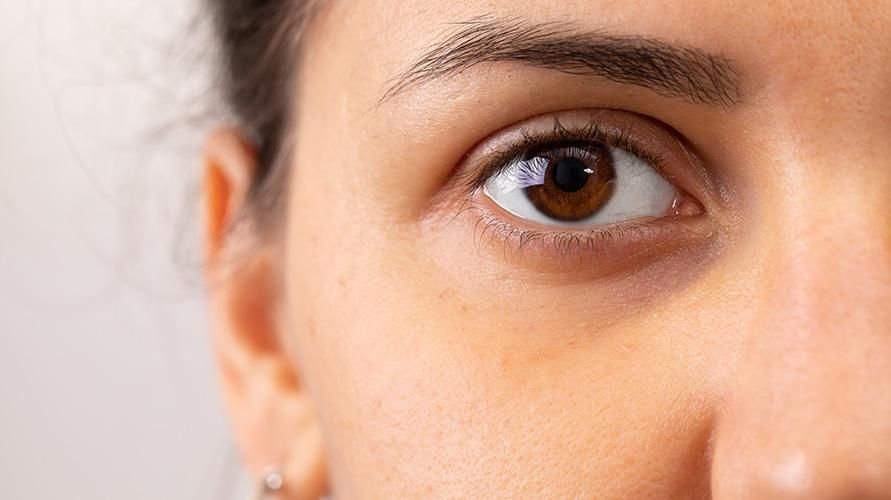 4 Optionen zum Entfernen dunkler Augenlider