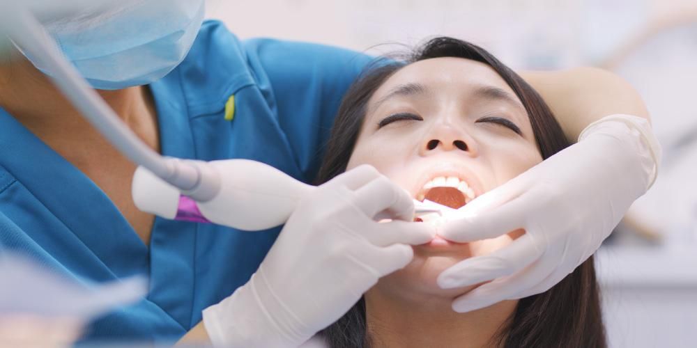 Знайте, як видалити затверділий зубний камінь
