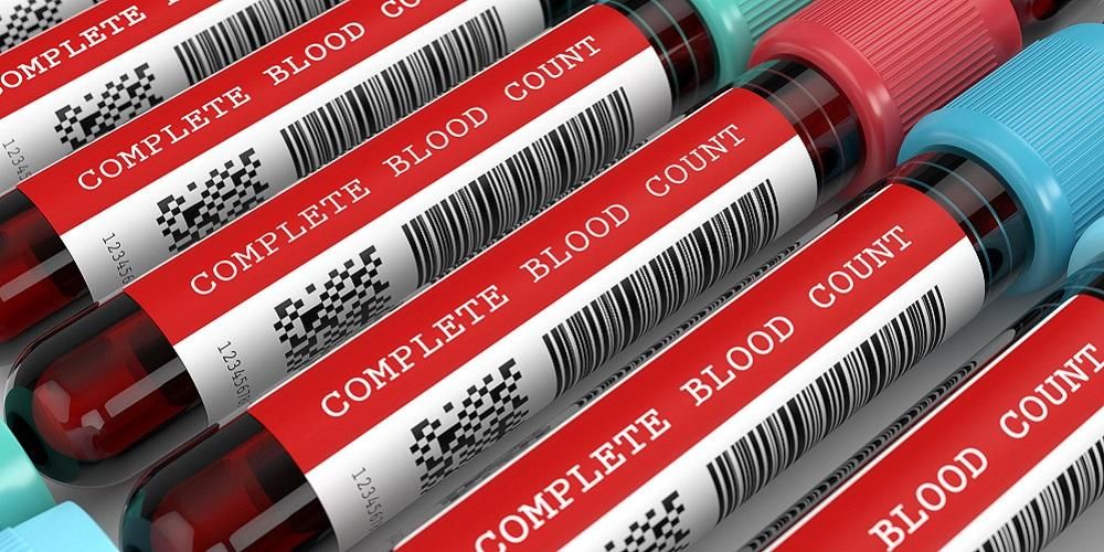 Poznaj elementy i cel pełnego badania krwi
