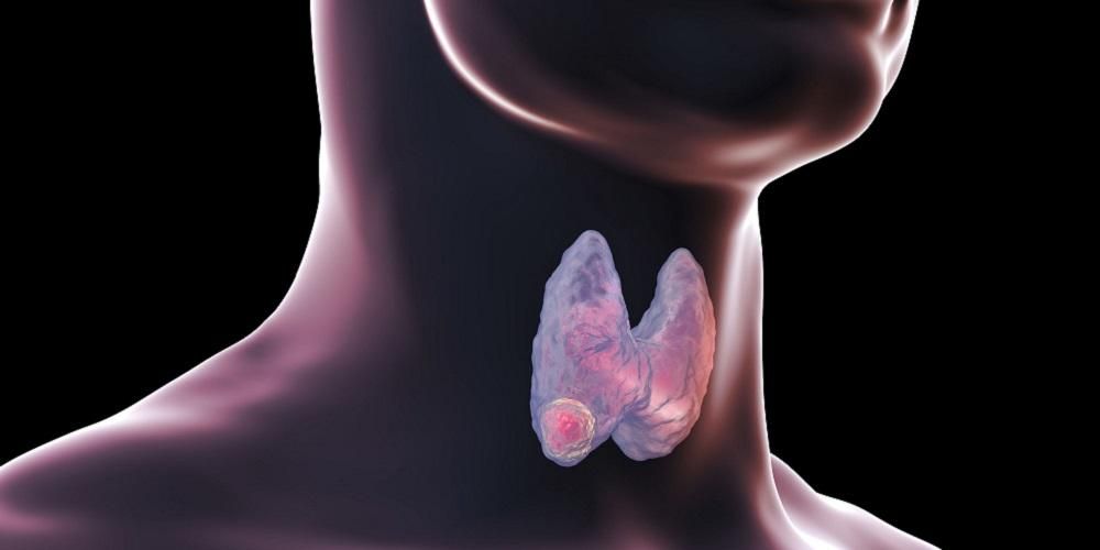 Преимущества и недостатки гормонов щитовидной железы могут спровоцировать ряд заболеваний.