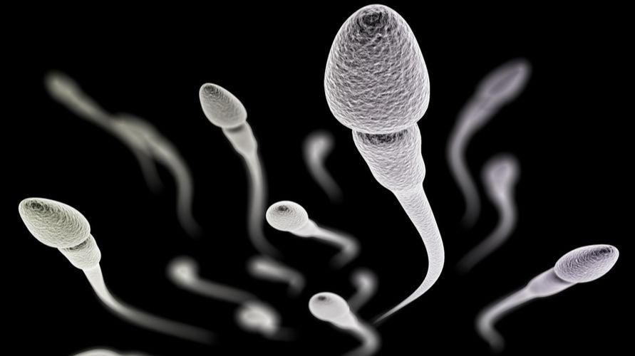 La teratozoospermia puede afectar la fertilidad masculina, reconocer las causas y cómo tratarla
