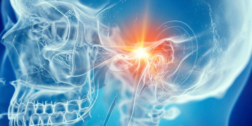 Apprenez à connaître l'articulation temporo-mandibulaire, le type d'articulation trouvé dans la mâchoire
