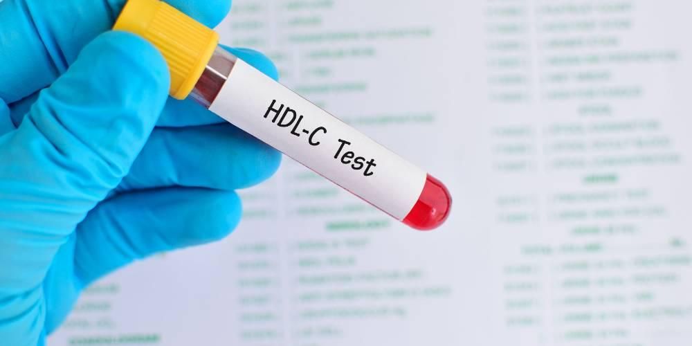 HDL el colesterol bueno, ¿cómo aumentarlo?
