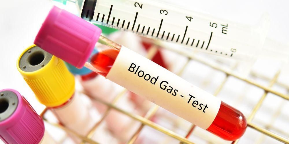 Känn blodgasanalys, detaljerad undersökning av vitala organs hälsa