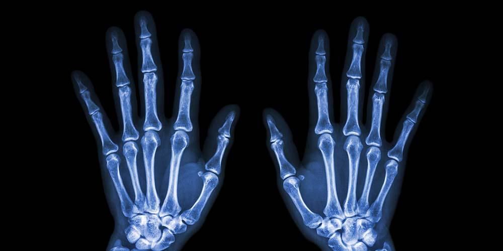 Prepoznavanje važnosti funkcije kosti prsta