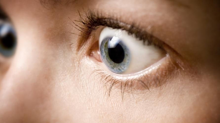 갑상선 기능 항진증으로 인해 볼록하고 튀어나온 눈이 생길 수 있습니다.