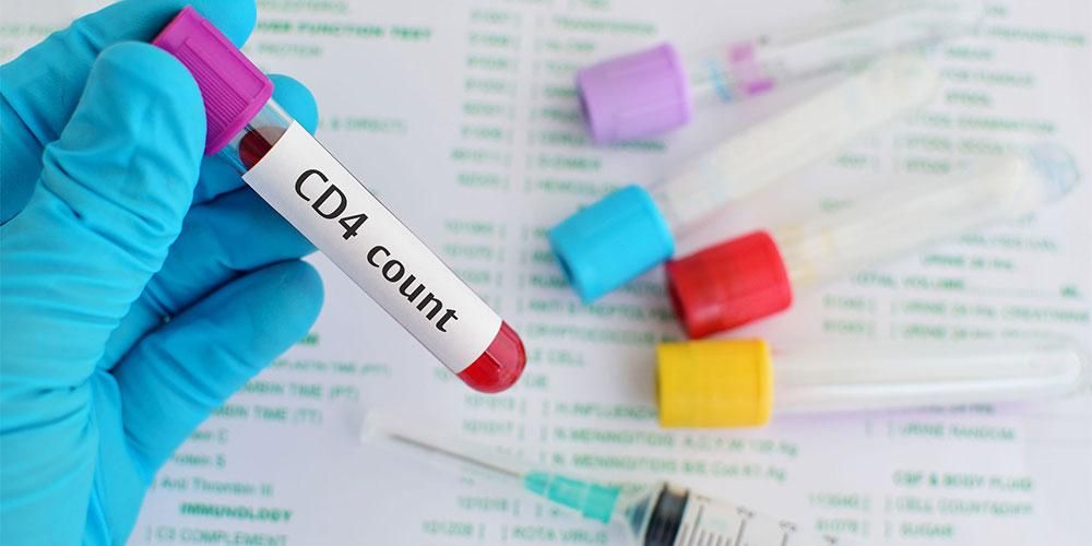 HIV 감염자를 위한 면역 체계의 필수 구성요소인 CD4 인식