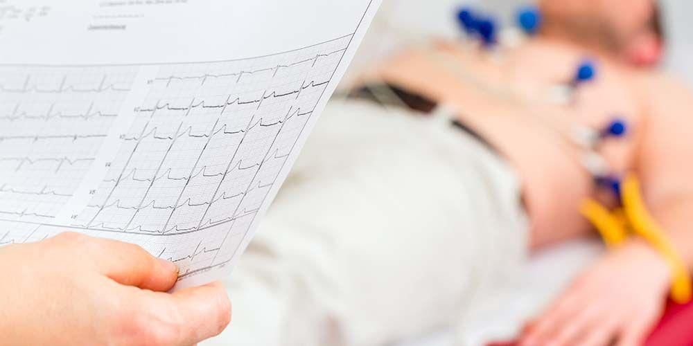 Das EKG-Installationsverfahren kennen und wissen, wann es durchgeführt werden sollte