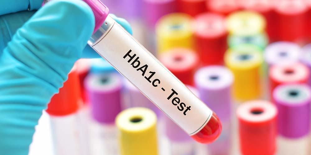 Що таке нормальний рівень HbA1C?