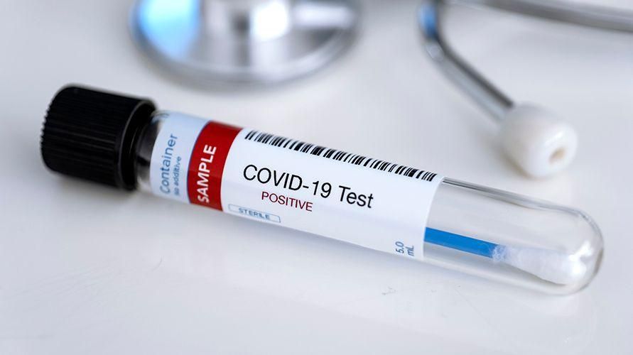 Förstå CT-värde i PCR-tester för Covid-19-diagnos
