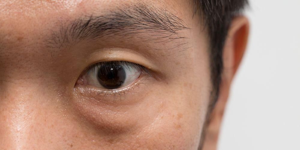 Значение подергивания нижнего левого глаза со стороны здоровья