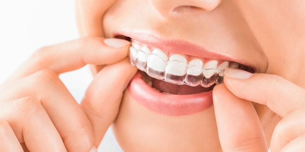 Machen Sie Ihr Lächeln attraktiver, wie funktioniert ein Zahnputzer?