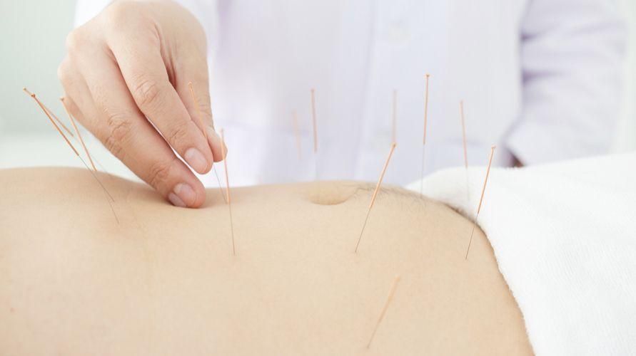 Ist die Akupunkturbehandlung bei Magensäure wirksam?