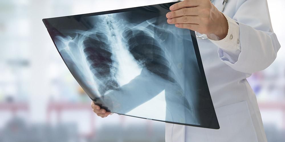 Egenskaperna hos blöta lungor och en rad sjukdomar som orsakar det