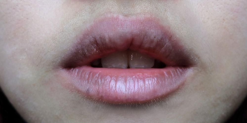 9 причин появления черных губ и как сделать их снова яркими